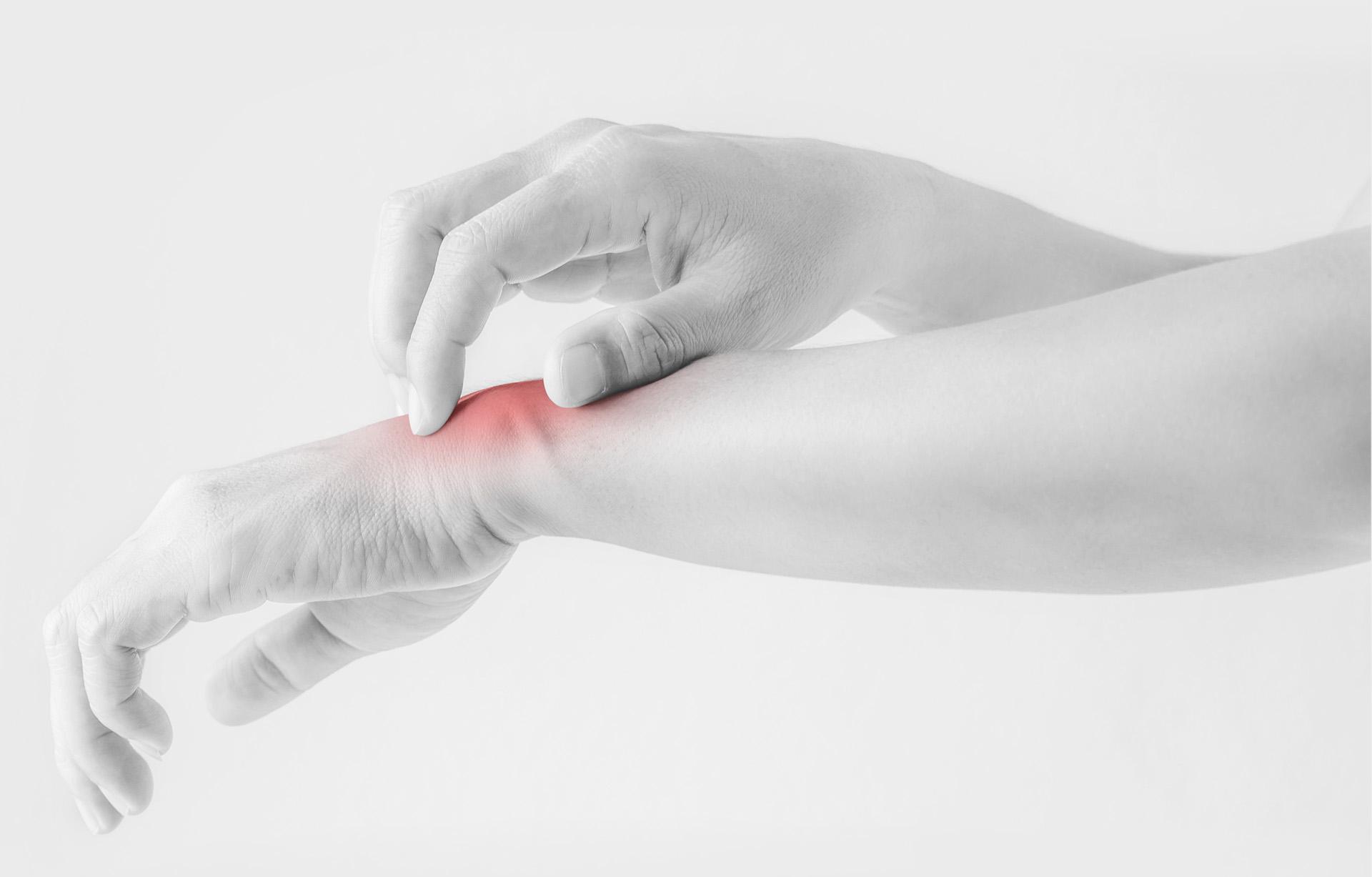 Woman scratching her wrist.